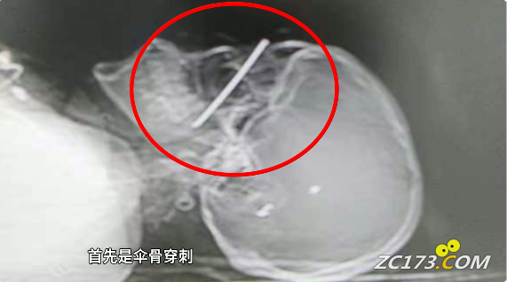 3e1deb036405b4f3240947df2581a6d3.png